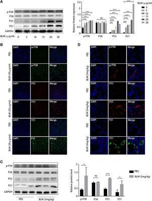 Arctiin-encapsulated DSPE-PEG bubble-like nanoparticles inhibit alveolar epithelial type 2 cell senescence to alleviate pulmonary fibrosis via the p38/p53/p21 pathway